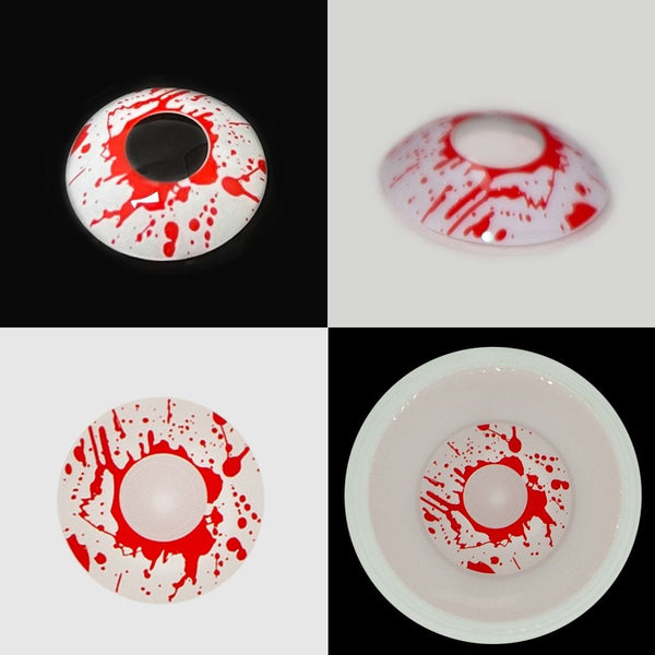 Blood stains Contact Lenses(12 months of use)